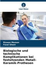 Biologische und technische Komplikationen bei festsitzenden Metall-Keramik-Prothesen af Rizwan Memon