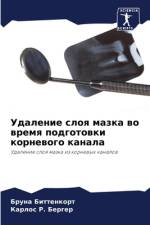 Udalenie sloq mazka wo wremq podgotowki kornewogo kanala af Bruna Bittenkort