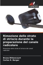 Rimozione dello strato di striscio durante la preparazione del canale radicolare af Bruna Bittencourt