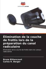 Élimination de la couche de frottis lors de la préparation du canal radiculaire af Bruna Bittencourt
