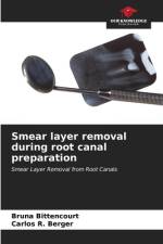 Smear layer removal during root canal preparation af Bruna Bittencourt