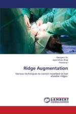 Ridge Augmentation af Georgeno Gl