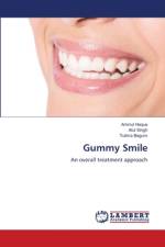 Gummy Smile af Aminul Haque