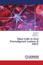 Mast Cells in Oral Premalignant Lesions & OSCC af Rupesh H.