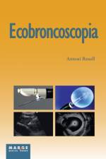Ecobroncoscopia af Antoni Rosell