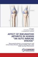 AFFECT OF RHEUMATOID ARTHRITIS IN HUMAN ¿AN AUTO IMMUNE DISEASE¿ af Y. Thangam