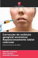 Correcção da exibição gengival excessiva: Reposicionamento labial com/com af Nandita Gautam