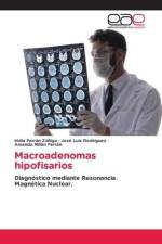 Macroadenomas hipofisarios af Iridia Ferrán Zúñiga