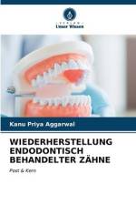 WIEDERHERSTELLUNG ENDODONTISCH BEHANDELTER ZÄHNE af Kanu Priya Aggarwal