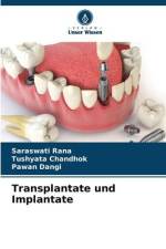 Transplantate und Implantate af Saraswati Rana