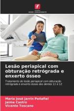 Lesão periapical com obturação retrógrada e enxerto ósseo af María José Jarrín Peñafiel