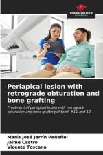 Periapical lesion with retrograde obturation and bone grafting af María José Jarrín Peñafiel