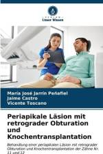 Periapikale Läsion mit retrograder Obturation und Knochentransplantation af María José Jarrín Peñafiel
