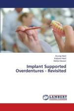Implant Supported Overdentures - Revisited af Anurag Hasti