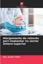 Alargamento do rebordo peri-implantar no sector ântero-superior af Dra. Joselin Mata