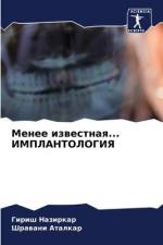 Menee izwestnaq... IMPLANTOLOGIYa af Girish Nazirkar