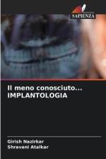Il meno conosciuto... IMPLANTOLOGIA af Girish Nazirkar