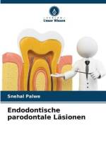 Endodontische parodontale Läsionen af Snehal Palwe