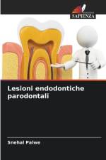 Lesioni endodontiche parodontali af Snehal Palwe