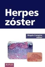 Herpes zóster af Magda Campins