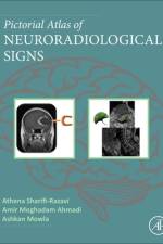 Pictorial Atlas of Neuroradiological Signs af Athena Sharifi-Razavi