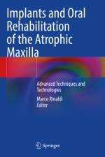 Implants and Oral Rehabilitation of the Atrophic Maxilla af Marco Rinaldi