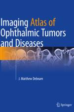 Imaging Atlas of Ophthalmic Tumors and Diseases af J Matthew Debnam