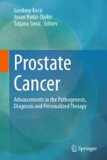 Prostate Cancer af Gordana Kocic