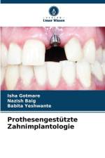 Prothesengestützte Zahnimplantologie af Isha Gotmare