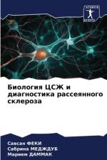Biologiq CSZh i diagnostika rasseqnnogo skleroza af Sawsan Feki