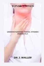 Tonsil Stones af J Waller