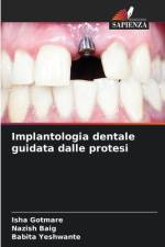 Implantologia dentale guidata dalle protesi af Isha Gotmare