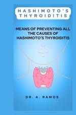 Hashimoto's Thyroiditis af A Ramos