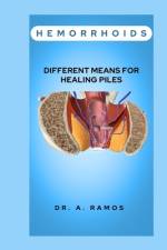 Hemorrhoids af A Ramos