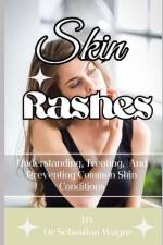 Skin Rashes af Sebastian Wayne
