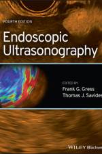 Endoscopic Ultrasonography