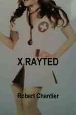 X RAYTED af Robert Chantler