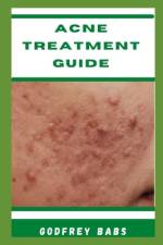 Acne Treatment Guide af Godfrey Babs
