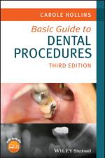Basic Guide to Dental Procedures af Carole (British Dental Association) Hollins