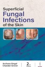 Superficial Fungal Infections of the Skin af Archana Singhal