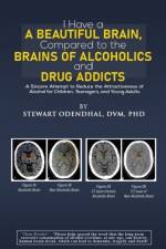 I Have a Beautiful Brain, Compared to the Brains of Alcoholics and Drug Addicts af DVM Odendhal