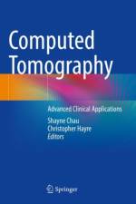Computed Tomography