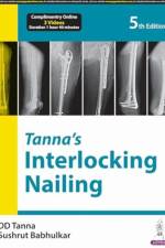 Tanna’s Interlocking Nailing af DD Tanna