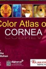 Color Atlas of Cornea af Mohan Sujatha