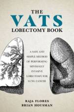 The VATS Lobectomy Book af M.D. Brian Housman