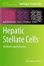 Hepatic Stellate Cells
