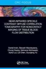 Near-infrared Speckle Contrast Diffuse Correlation Tomography for Noncontact Imaging of Tissue Blood Flow Distribution af Daniel Irwin