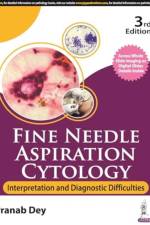 Fine Needle Aspiration Cytology af Pranab Dey