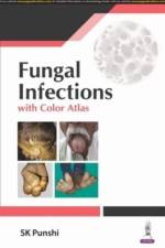 Fungal Infections af SK Punshi