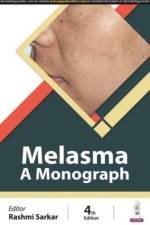 Melasma af Rashmi Sarkar